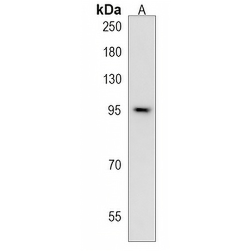 CTAGE5 Rabbit Polyclonal Antibody