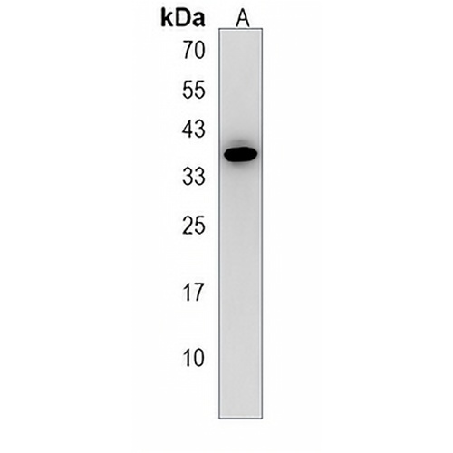 BTG3 Rabbit Polyclonal Antibody