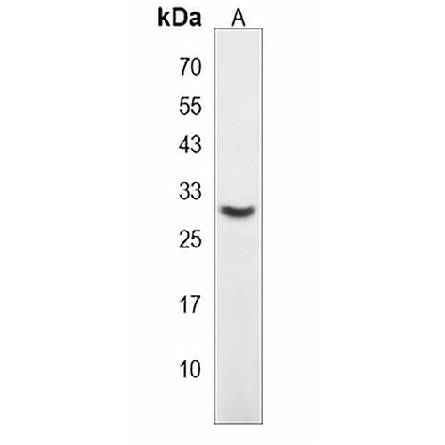 DNAJC27 Rabbit Polyclonal Antibody