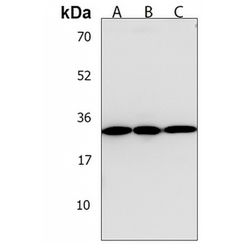 TPM4 Rabbit Polyclonal Antibody