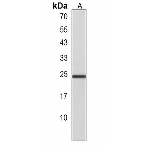 RPL15 Rabbit Polyclonal Antibody