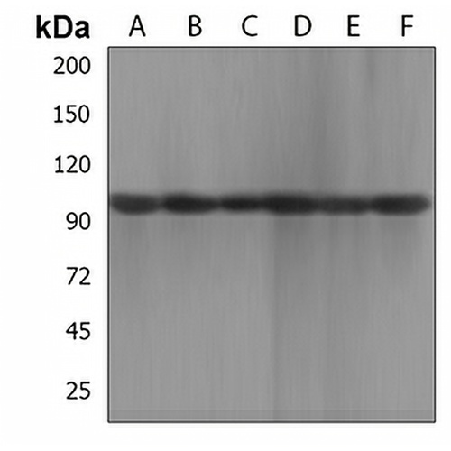 XYLT1 Rabbit Polyclonal Antibody