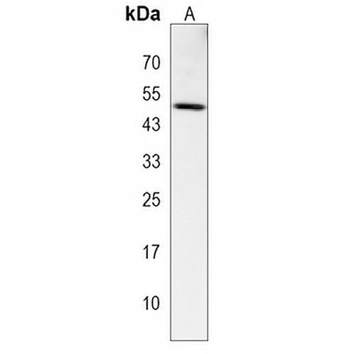 DSN1 Rabbit Polyclonal Antibody