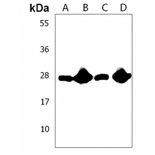 RAB11B Rabbit Polyclonal Antibody