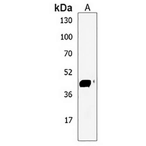GAL3ST4 Rabbit Polyclonal Antibody