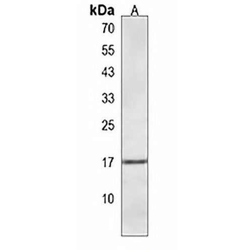 Hemoglobin &theta; Rabbit Polyclonal Antibody