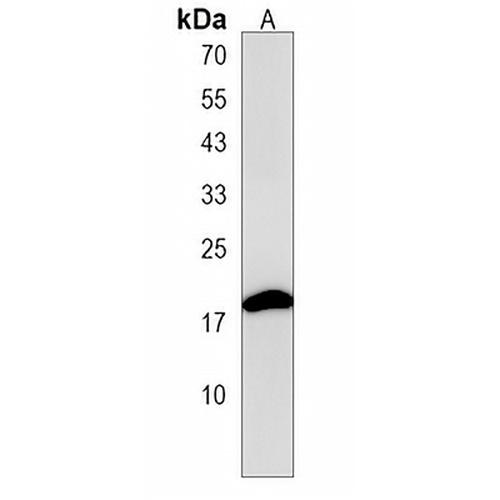 STMN3 Rabbit Polyclonal Antibody