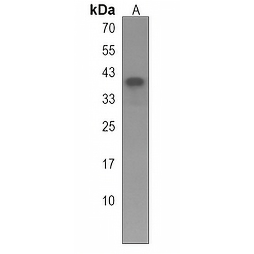 PGA4 Rabbit Polyclonal Antibody