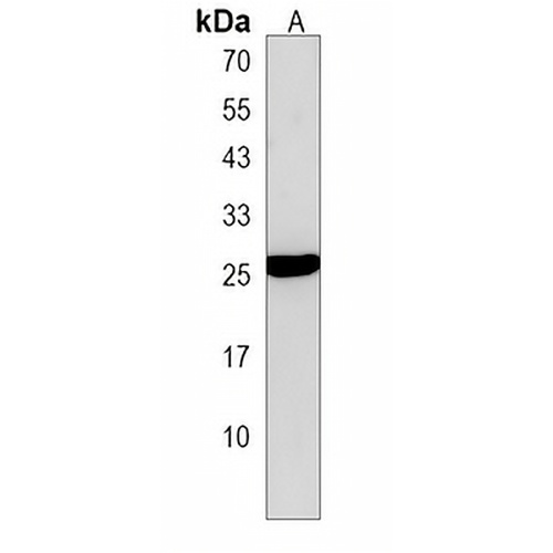 PIGH Rabbit Polyclonal Antibody
