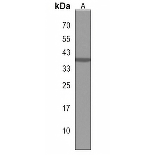NIT1 Rabbit Polyclonal Antibody