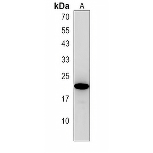 CSHL1 Rabbit Polyclonal Antibody