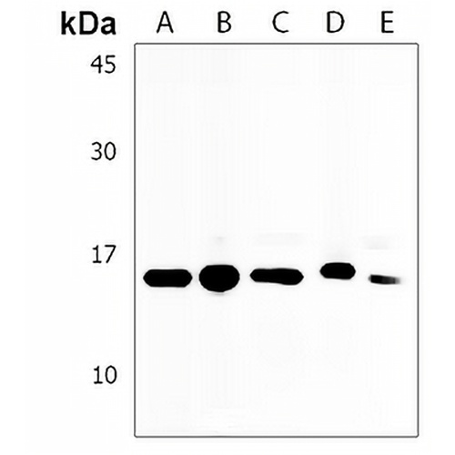 HIST1H2AB Rabbit Polyclonal Antibody