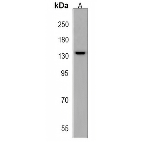 ATAD2 Rabbit Polyclonal Antibody