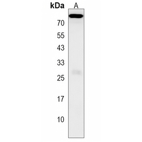 WBSCR17 Rabbit Polyclonal Antibody
