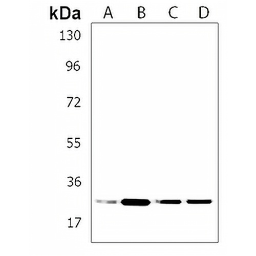 SSR2 Rabbit Polyclonal Antibody