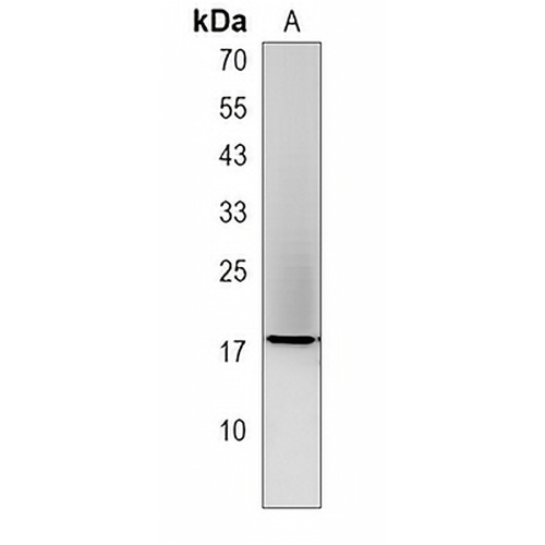 GAGE2B Rabbit Polyclonal Antibody