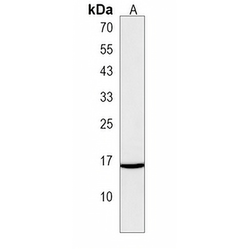 TMEM52B Rabbit Polyclonal Antibody