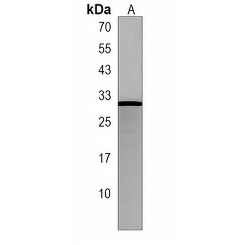 MRAP2 Rabbit Polyclonal Antibody