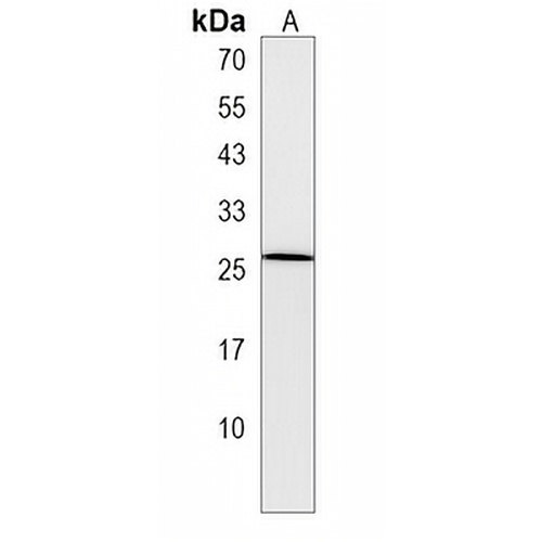 LHFPL1 Rabbit Polyclonal Antibody