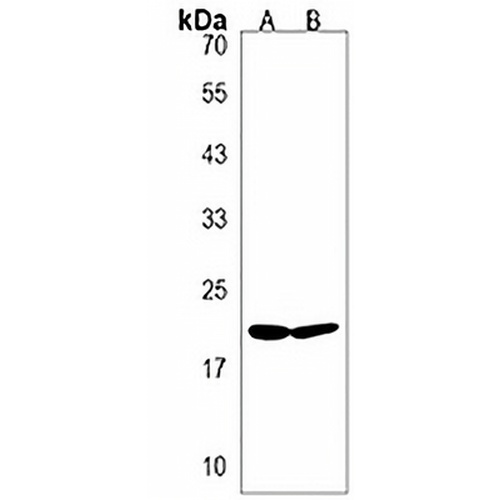 BIK Rabbit Polyclonal Antibody