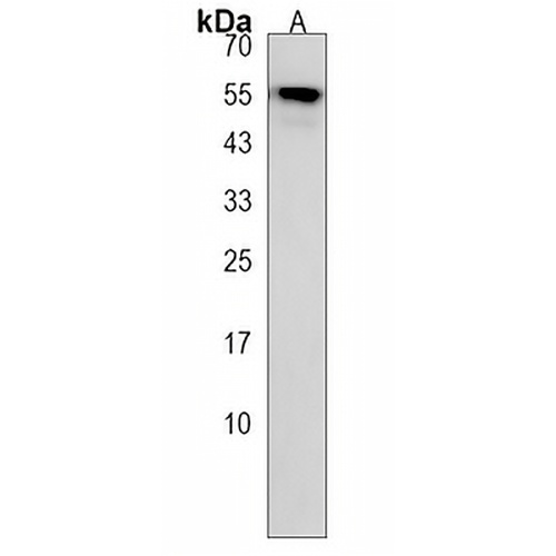 PALMD Rabbit Polyclonal Antibody