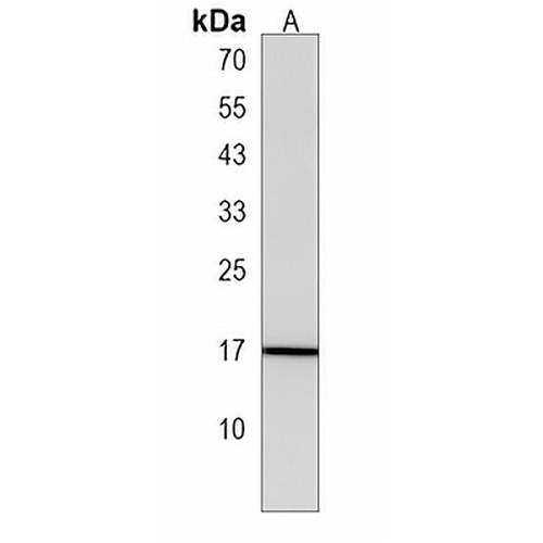 GPHB5 Rabbit Polyclonal Antibody