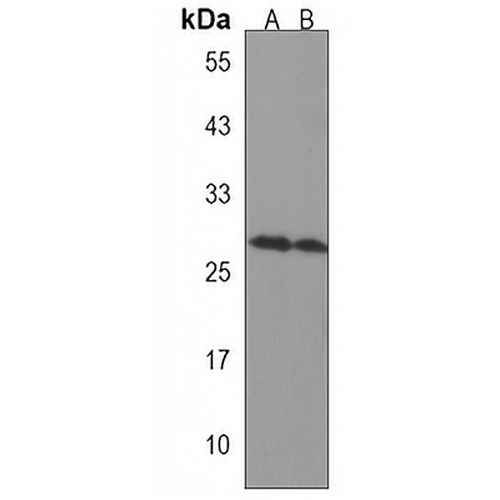 CCDC134 Rabbit Polyclonal Antibody