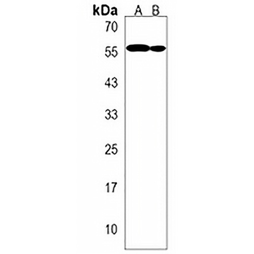 TRIM64 Rabbit Polyclonal Antibody