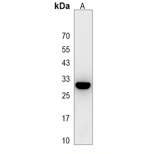 YAE1D1 Rabbit Polyclonal Antibody