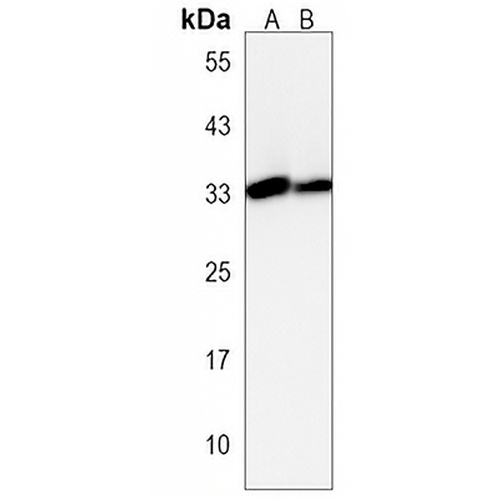 PI15 Rabbit Polyclonal Antibody