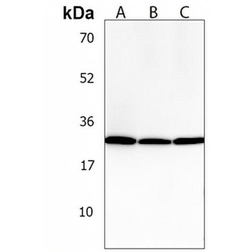 PGAM4 Rabbit Polyclonal Antibody