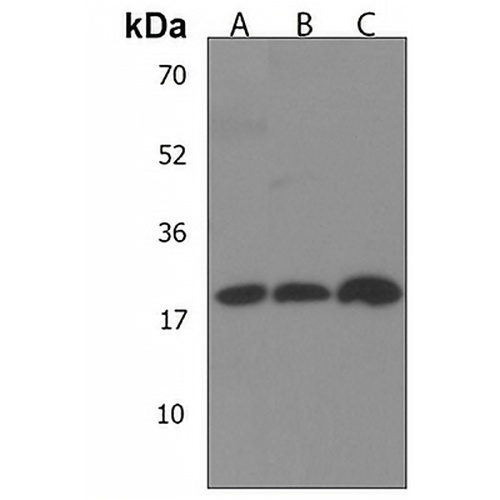 DHFRL1 Rabbit Polyclonal Antibody