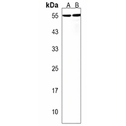 PRCP Rabbit Polyclonal Antibody