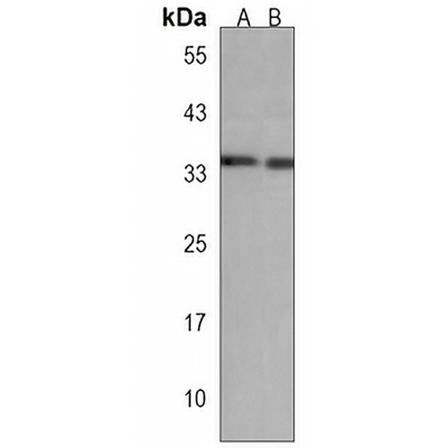 TAF8 Rabbit Polyclonal Antibody