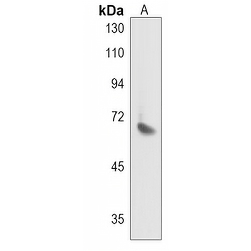 JPH2 Rabbit Polyclonal Antibody