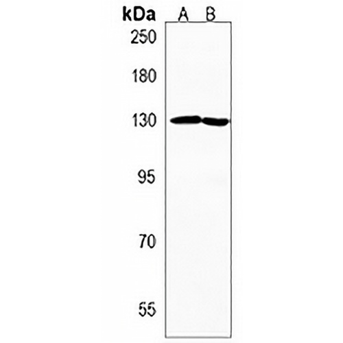 ZBTB11 Rabbit Polyclonal Antibody