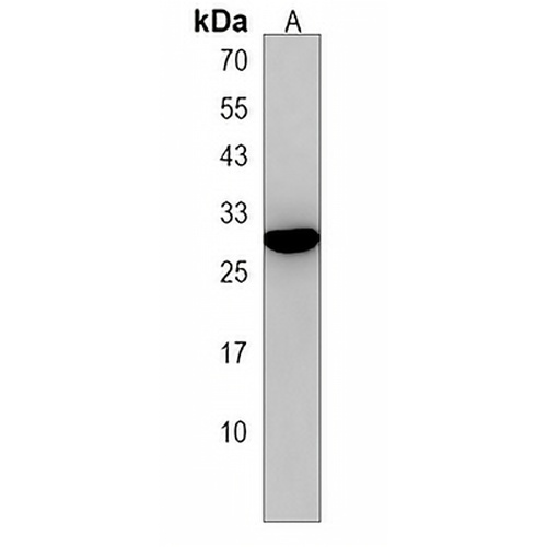 EMP2 Rabbit Polyclonal Antibody