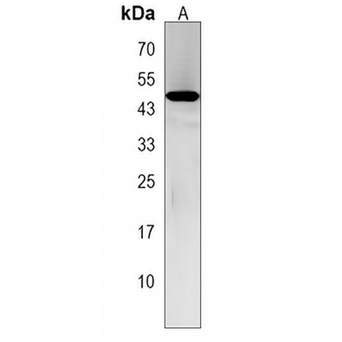 TSPYL5 Rabbit Polyclonal Antibody