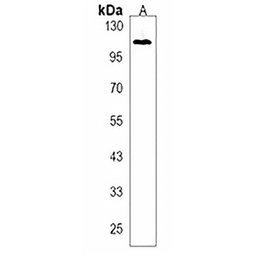 RHBDF2 Rabbit Polyclonal Antibody