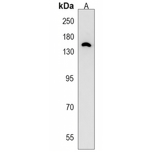 TIAM2 Rabbit Polyclonal Antibody