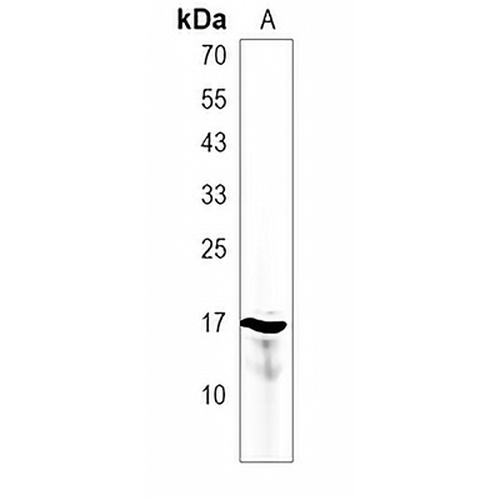 NRARP Rabbit Polyclonal Antibody