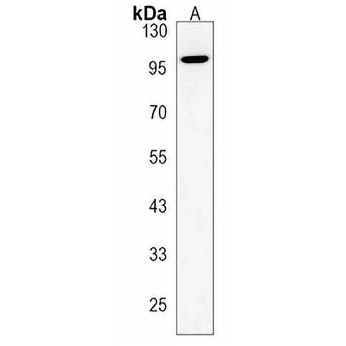 ZCCHC14 Rabbit Polyclonal Antibody