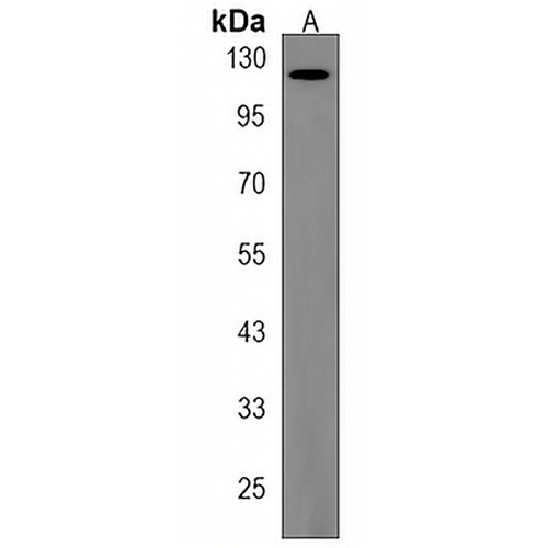 TTC13 Rabbit Polyclonal Antibody