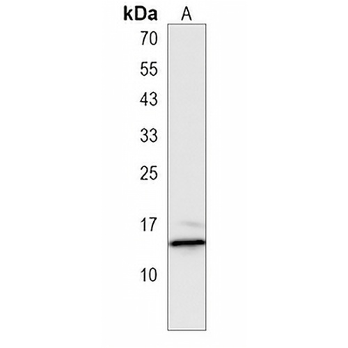 HIST2H2AA3 Rabbit Polyclonal Antibody