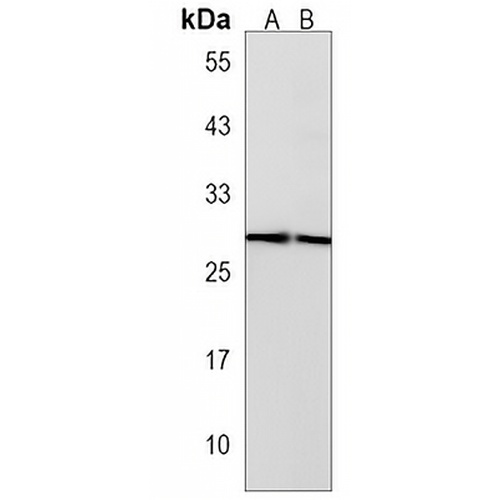 Histone H1X Rabbit Polyclonal Antibody