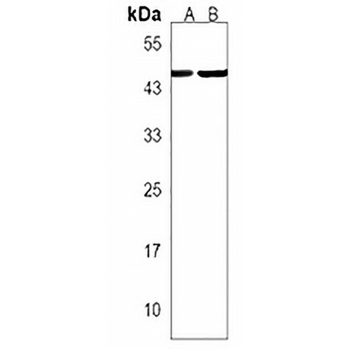 CCR10 Rabbit Polyclonal Antibody