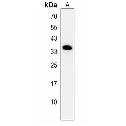 DHRS7C Rabbit Polyclonal Antibody