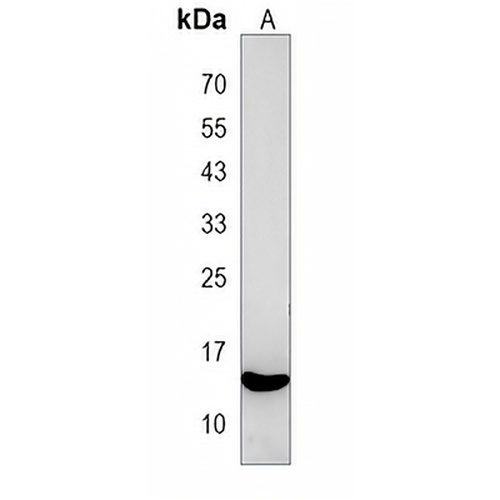 PIK3IP1 Rabbit Polyclonal Antibody