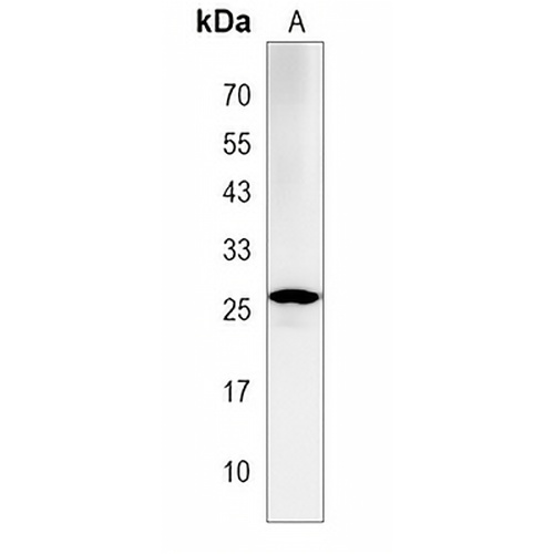 LAPTM4A Rabbit Polyclonal Antibody