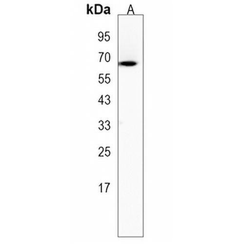 POF1B Rabbit Polyclonal Antibody